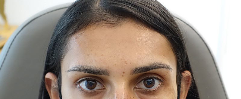 Augenbrauen vorher