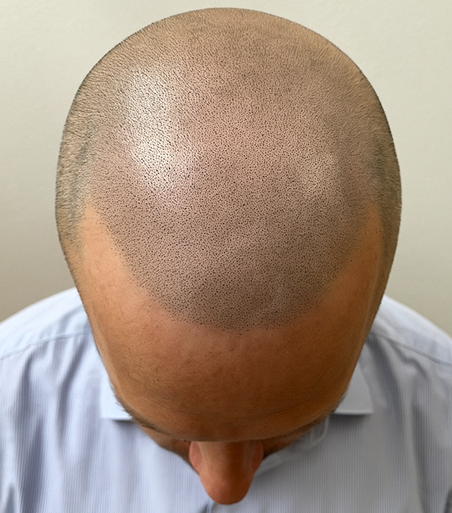 Haarpigmentierung von beperfect in Bremgarten