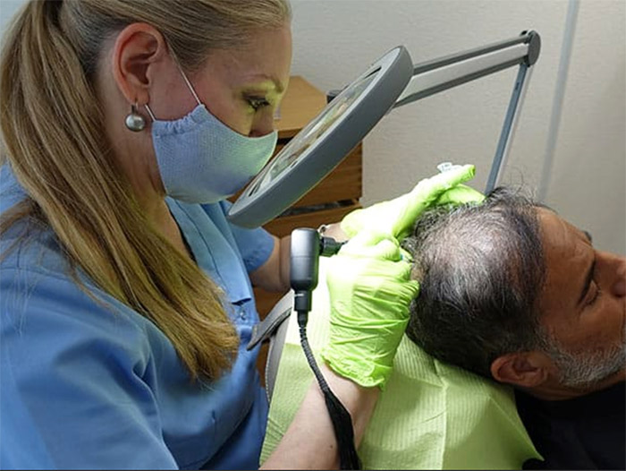 Monica Carrara erklärt dxen Unterschied zwischen SMP und haartransplantation