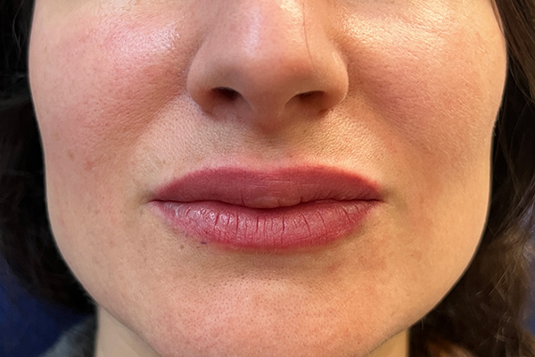 permanent make up lippen Nachher