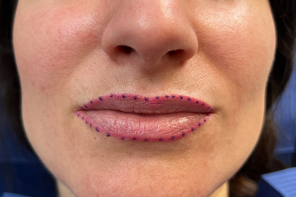 permanent make up lippen anzeichnen