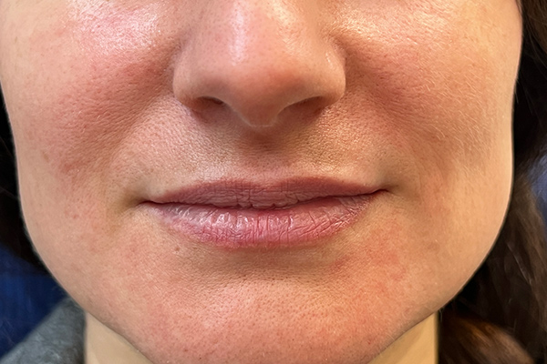 permanent make up lippen vorher beperfect