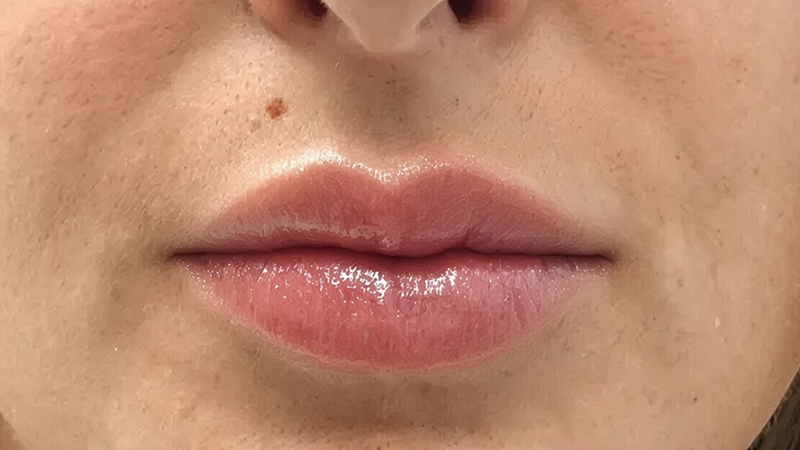 aquarell lippen beperfect bremgarten
